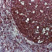 Anti-CD20 antibody [L26] used in IHC (Paraffin sections) (IHC-P). GTX29475